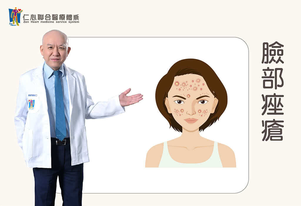青春痘(臉部痤瘡)
